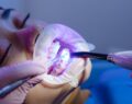 aparat ortodontyczny refundacja
